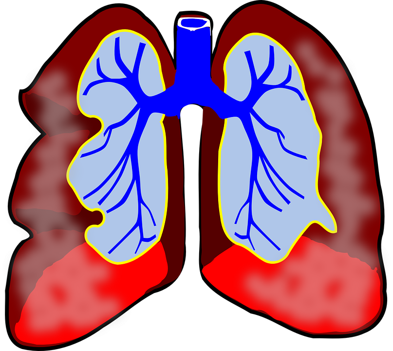 ako sa lieci astma, astmaticky zachvat